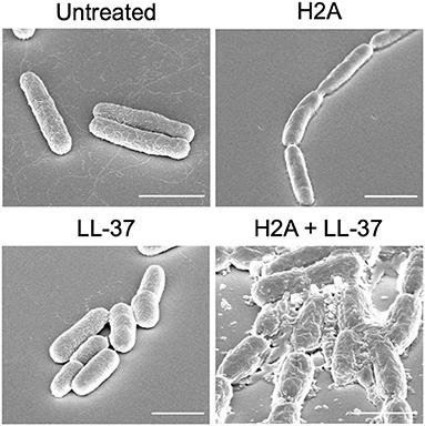 Developing Antimicrobial Synergy With AMPs